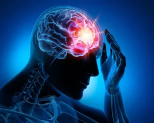 How Can Eason Car Accident Personal Injury Lawyers Help After a Brain Injury?