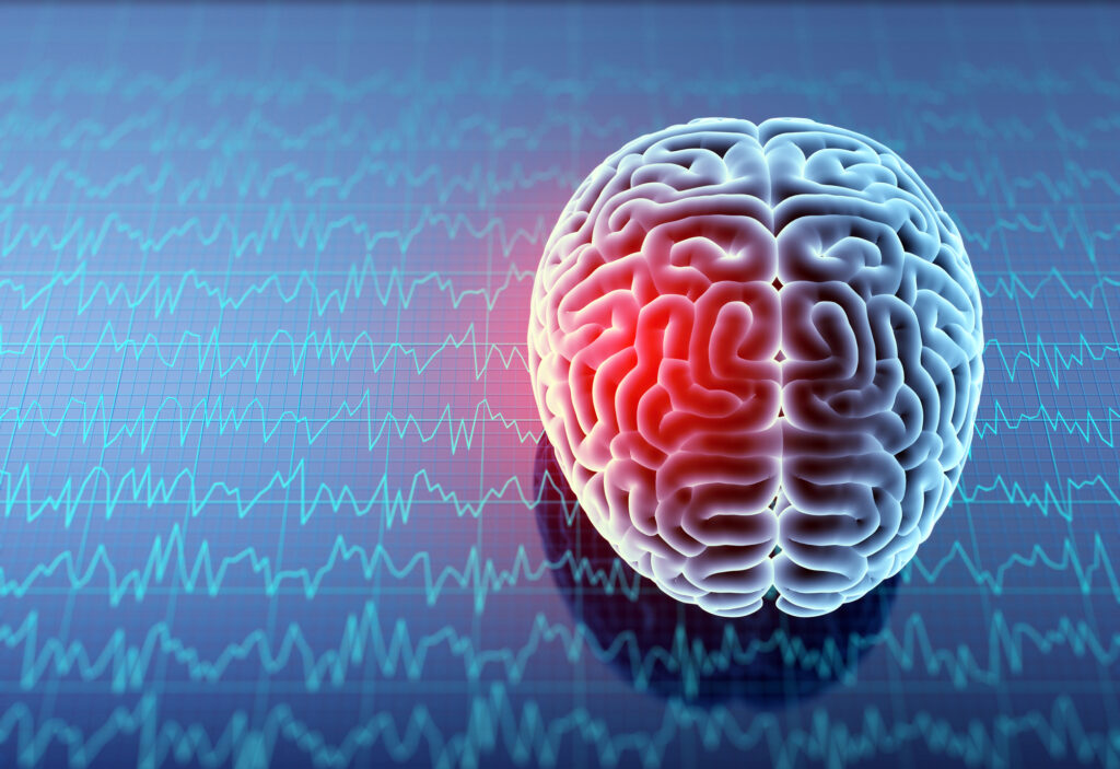 Identifying a Brain Contusion Injury